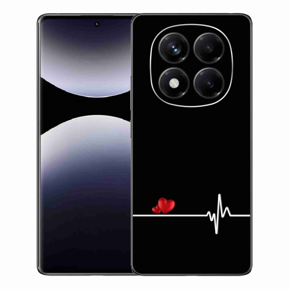 Gelový kryt mmCase na Xiaomi Redmi Note 14 Pro - srdce a tep černé pozadí