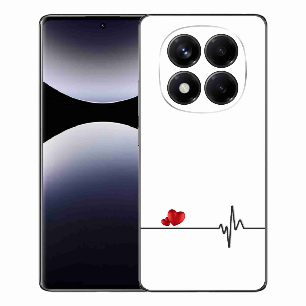 Gelový kryt mmCase na Xiaomi Redmi Note 14 Pro - srdce a tep bílé pozadí