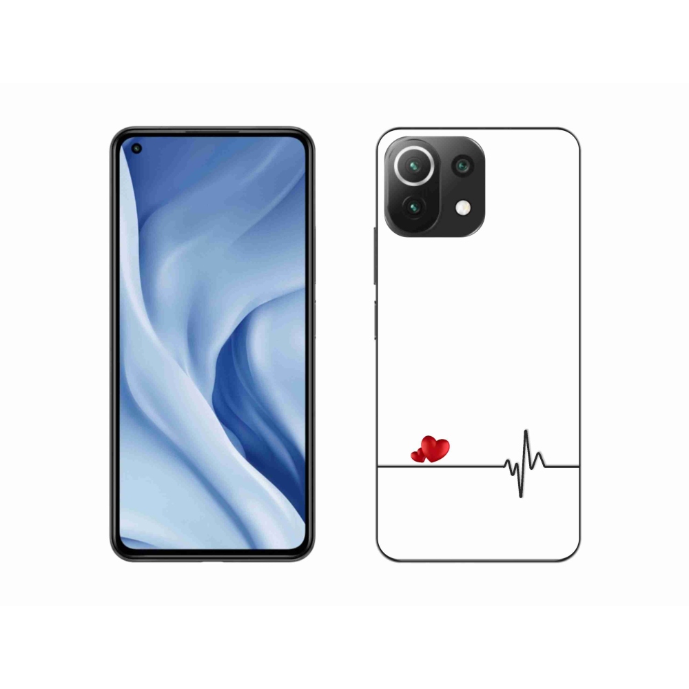 Gelový kryt mmCase na Xiaomi 11 Lite 5G NE - srdce a tep bílé pozadí