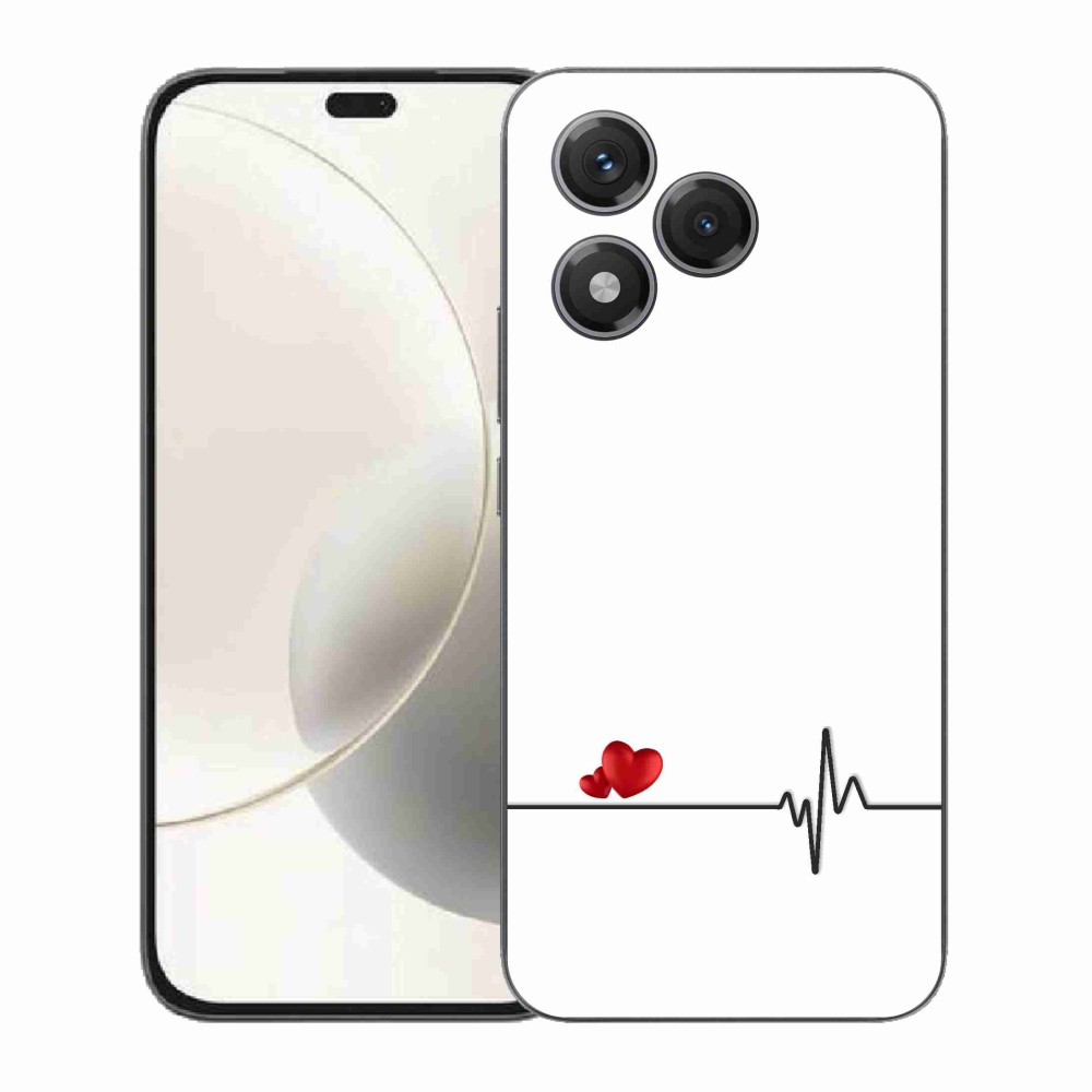 Gelový kryt mmCase na Honor 400 Lite - srdce a tep bílé pozadí