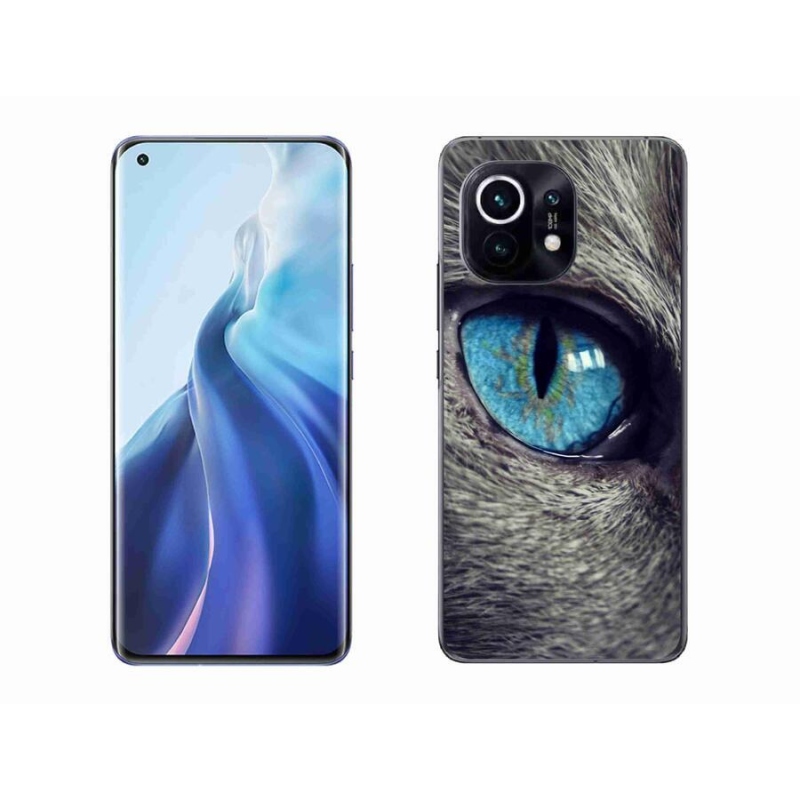 Gelové pouzdro mmCase na mobil Xiaomi Mi 11 - modré kočičí oko