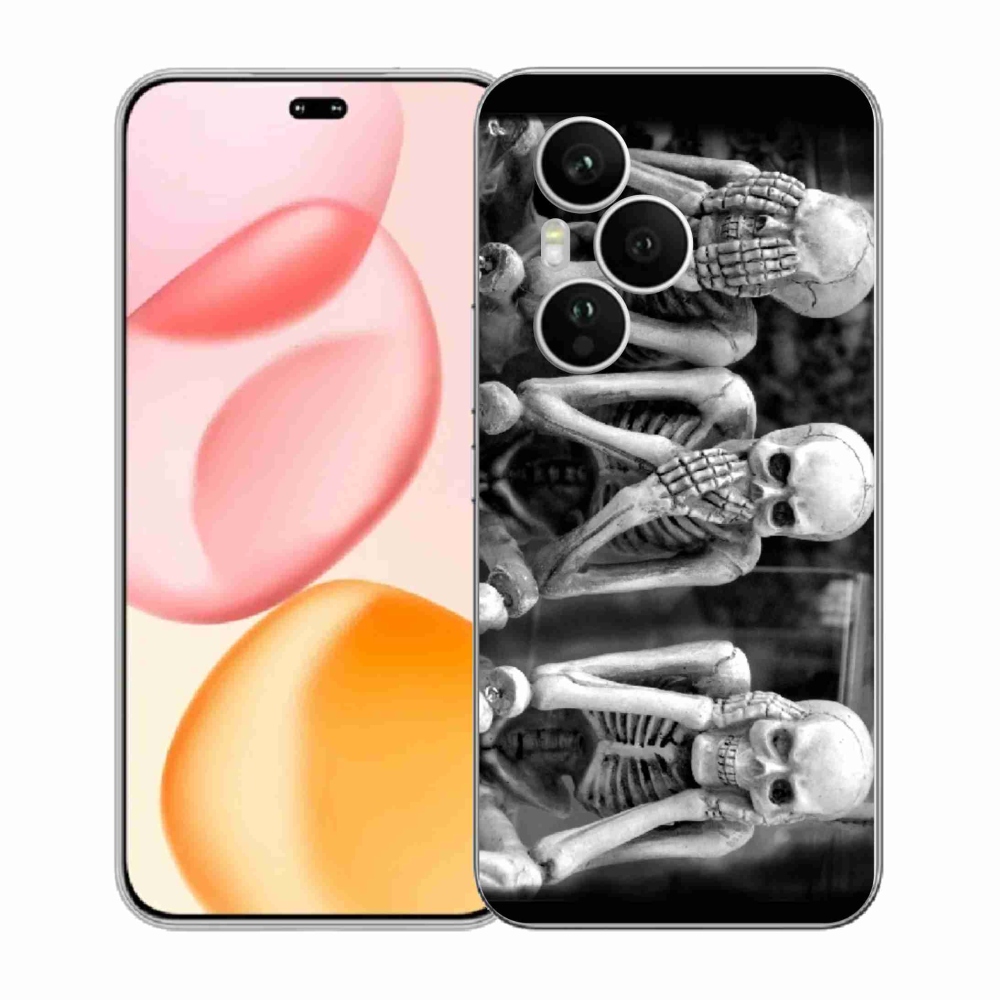 Gelový kryt mmCase na Honor 400 Pro - kostlivci