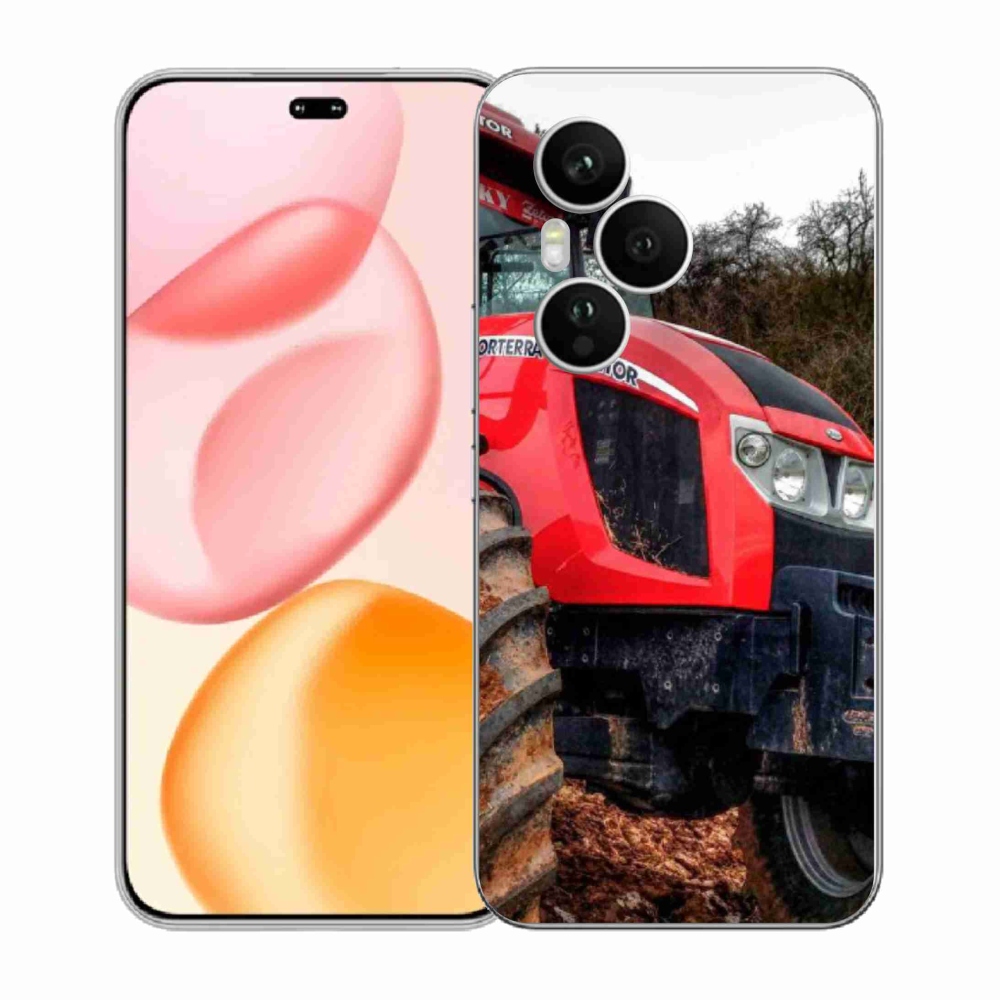 Gelový kryt mmCase na Honor 400 Pro - zetor