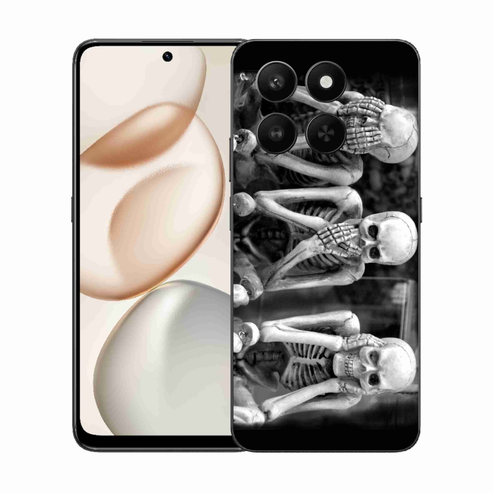 Gelový kryt mmCase na Honor 400 Smart 5G/4G/Honor X7d - kostlivci