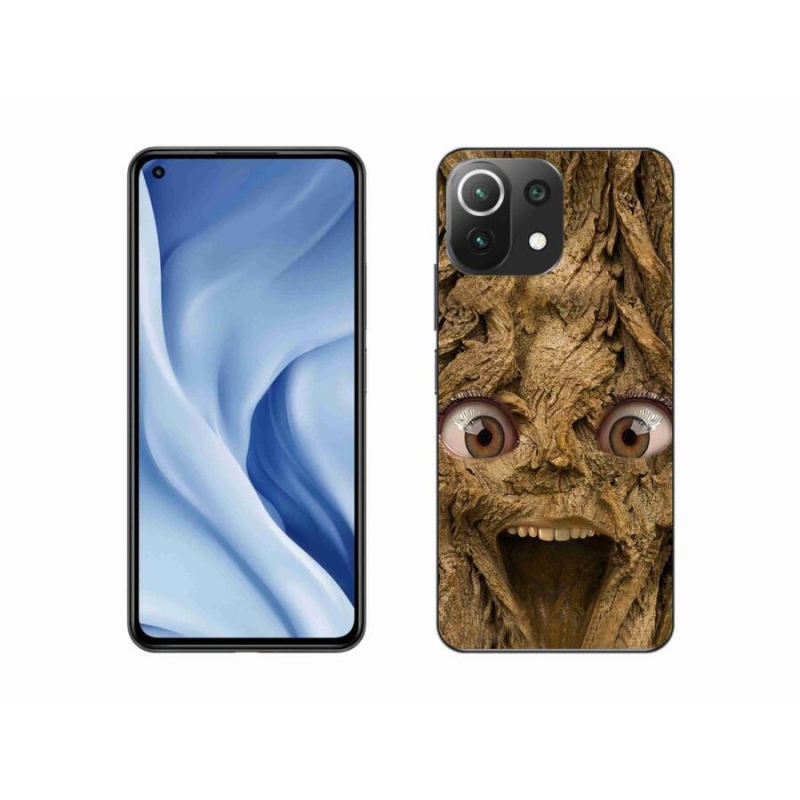 Gelový kryt mmCase na mobil Xiaomi 11 Lite 5G NE - veselý strom s očima