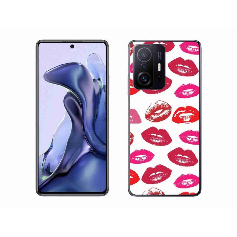 Gelový kryt mmCase na mobil Xiaomi 11T - rty