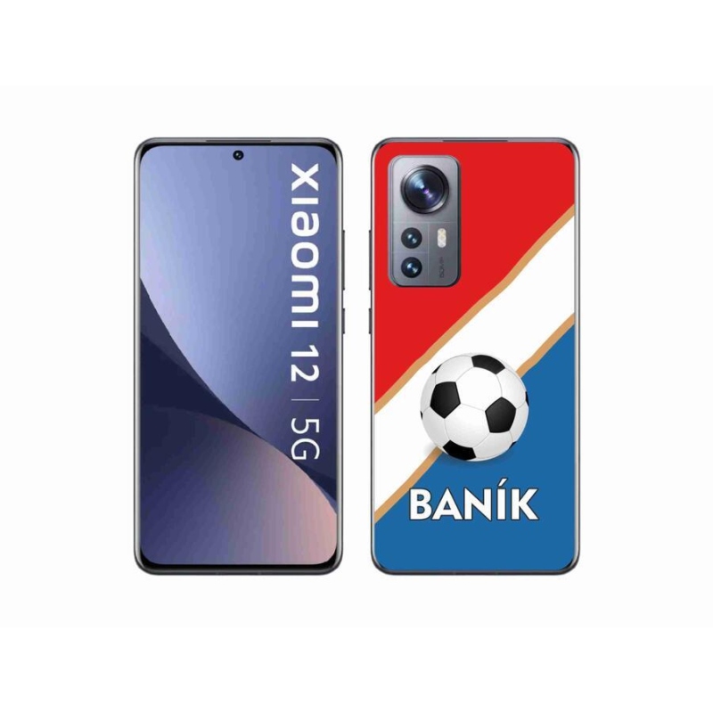 Gelový kryt mmCase na mobil Xiaomi 12X - Baník
