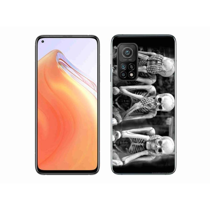 Gelový kryt mmCase na mobil Xiaomi Mi 10T 5G - kostlivci