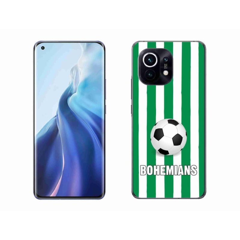 Gelový kryt mmCase na mobil Xiaomi Mi 11 - Bohemians