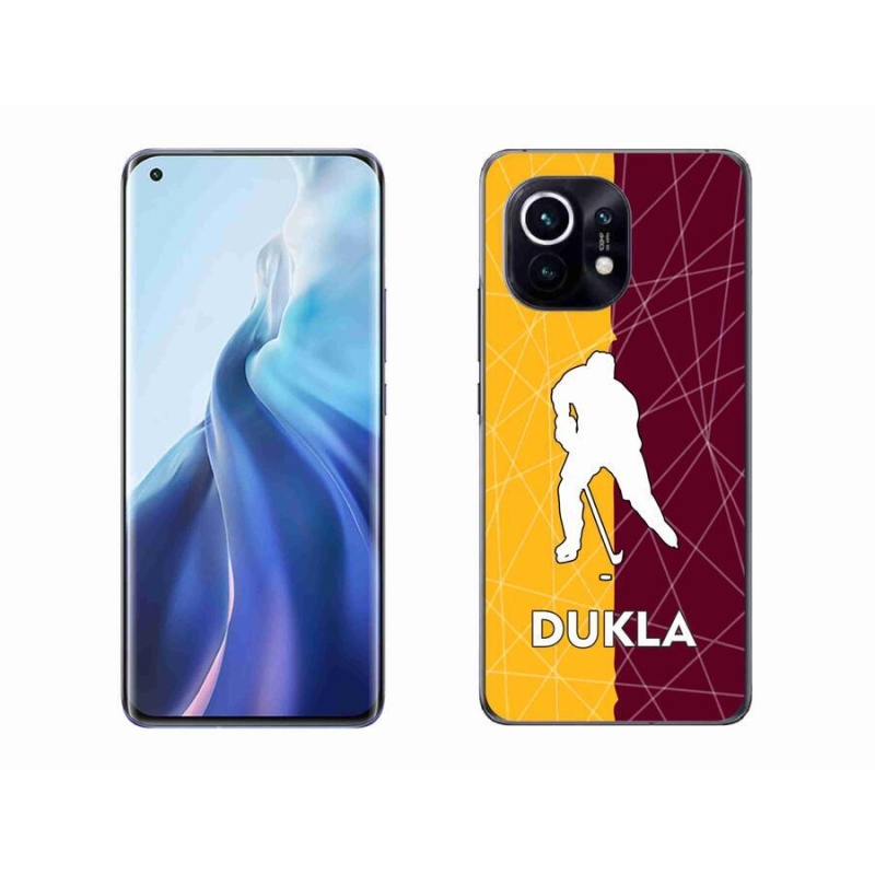 Gelový kryt mmCase na mobil Xiaomi Mi 11 - Dukla