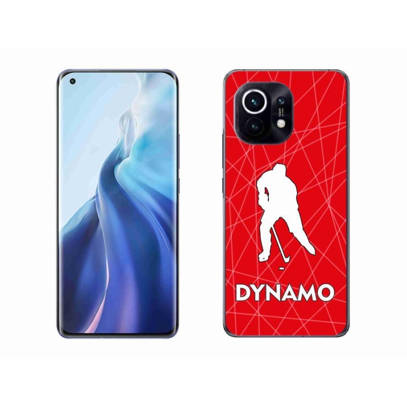 Gelový kryt mmCase na mobil Xiaomi Mi 11 - Dynamo 2
