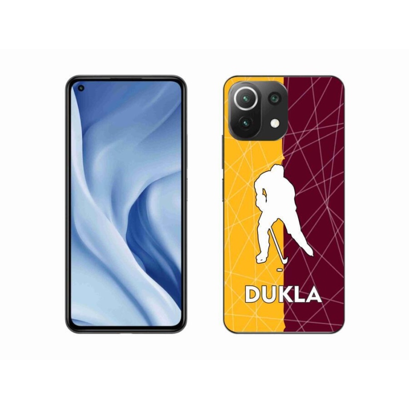 Gelový kryt mmCase na mobil Xiaomi Mi 11 Lite 4G/5G - Dukla