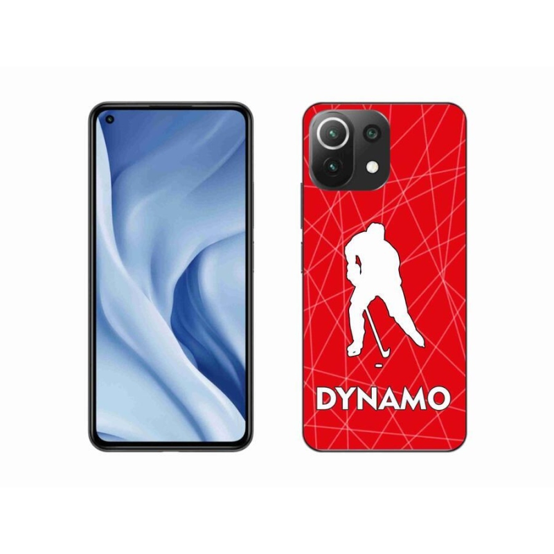 Gelový kryt mmCase na mobil Xiaomi Mi 11 Lite 4G/5G - Dynamo 2