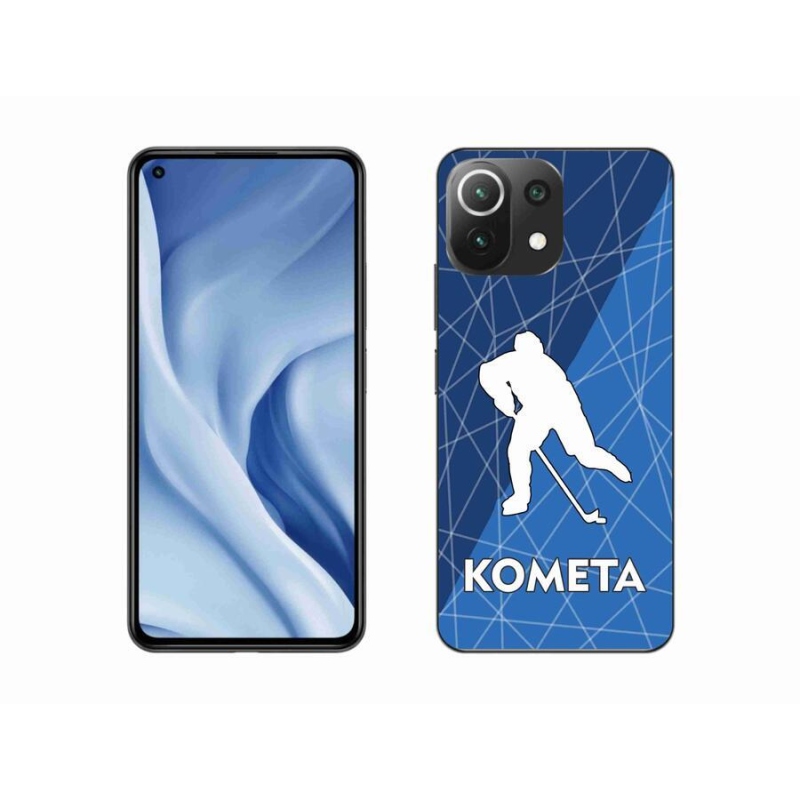 Gelový kryt mmCase na mobil Xiaomi Mi 11 Lite 4G/5G - Kometa
