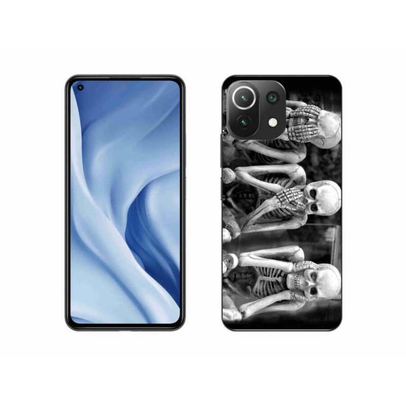 Gelový kryt mmCase na mobil Xiaomi Mi 11 Lite 4G/5G - kostlivci