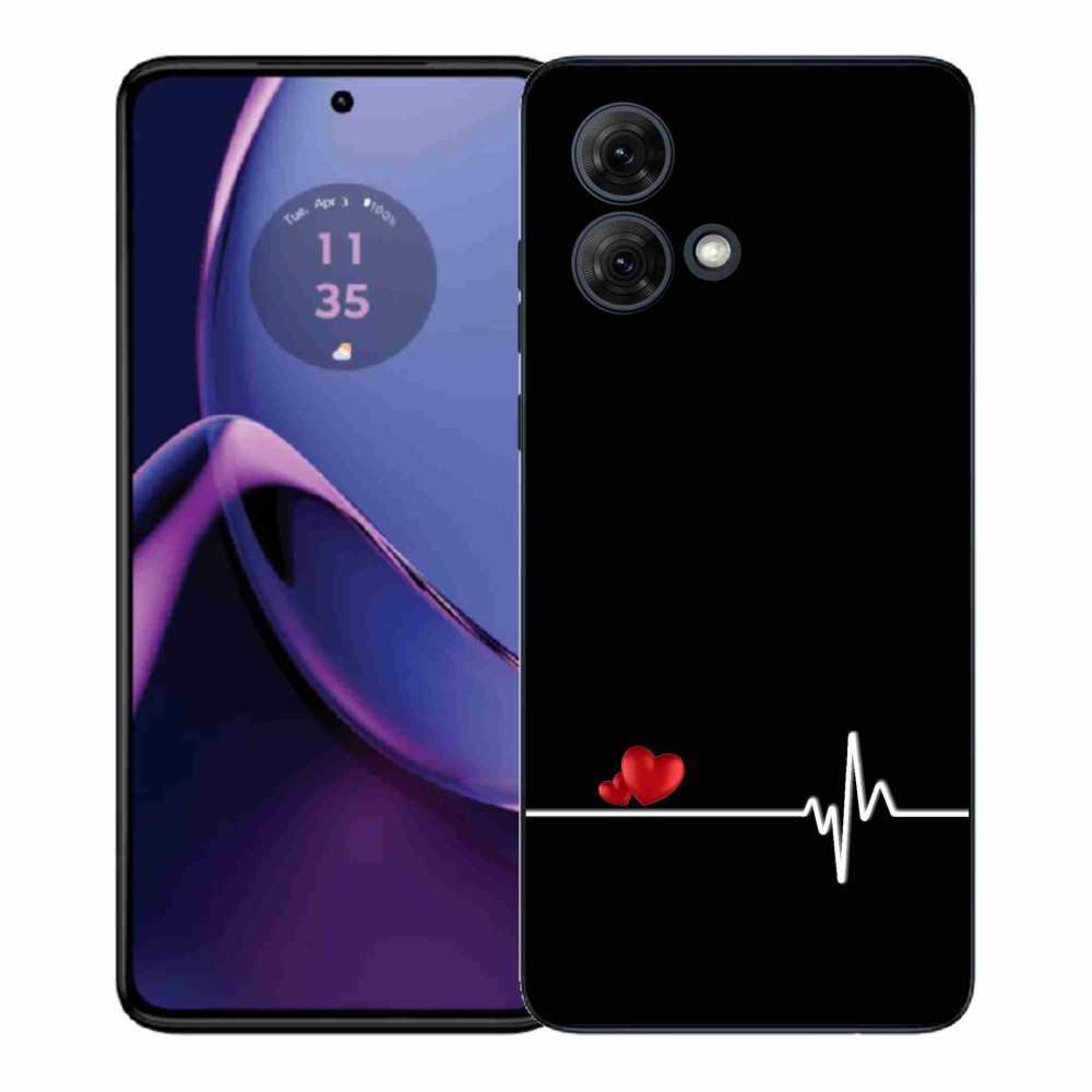 Gelový kryt mmCase na Motorola Moto G84 5G - srdce a tep černé pozadí