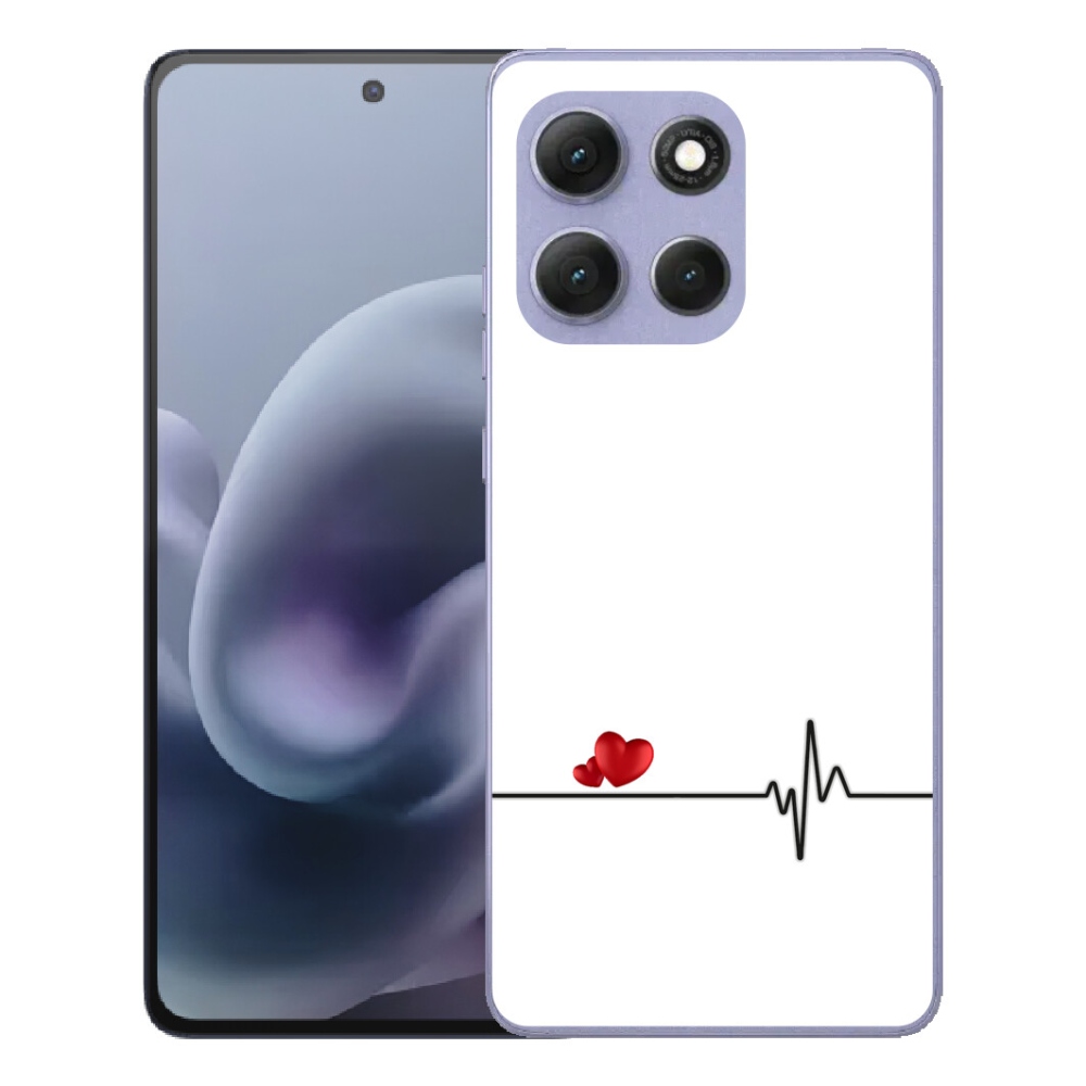 Gelový kryt mmCase na Motorola Moto G86 Power 5G - srdce a tep bílé pozadí