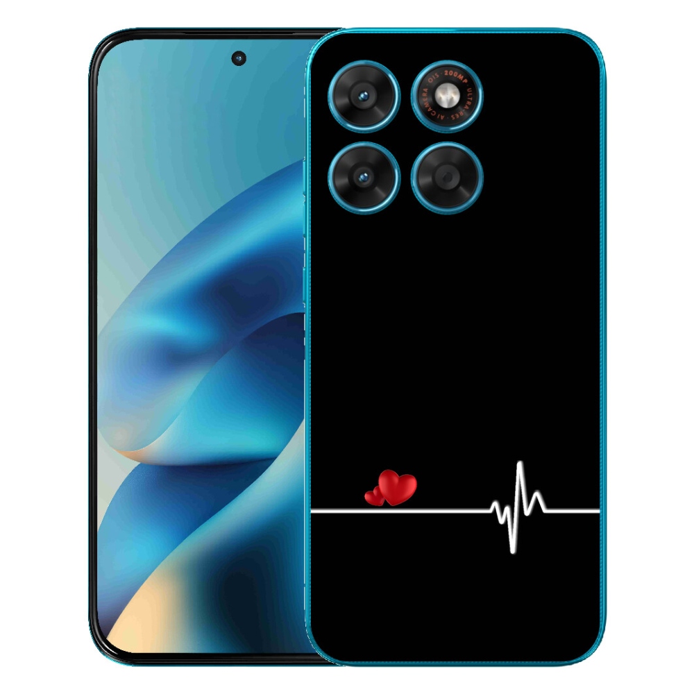 Gelový kryt mmCase na Motorola Moto G87/G77/G67 - srdce a tep černé pozadí