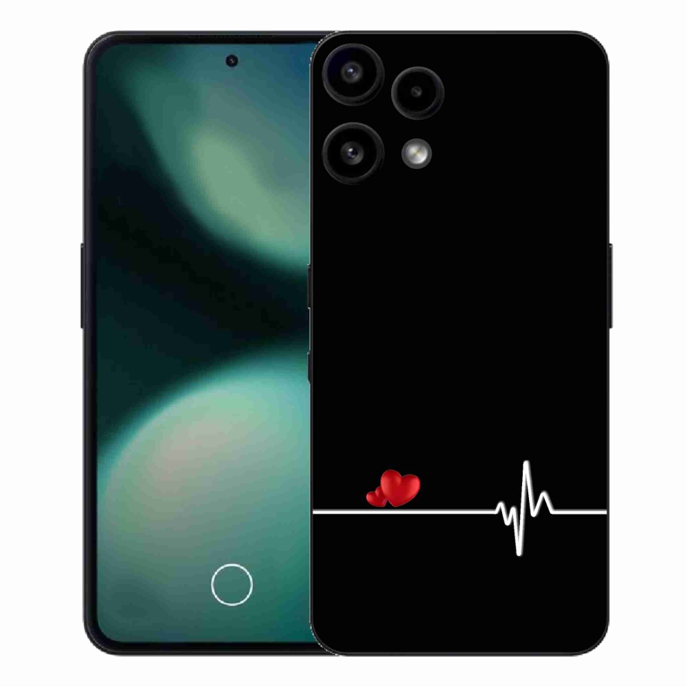 Gelový kryt mmCase na Nothing Phone (3a) Lite - srdce a tep černé pozadí