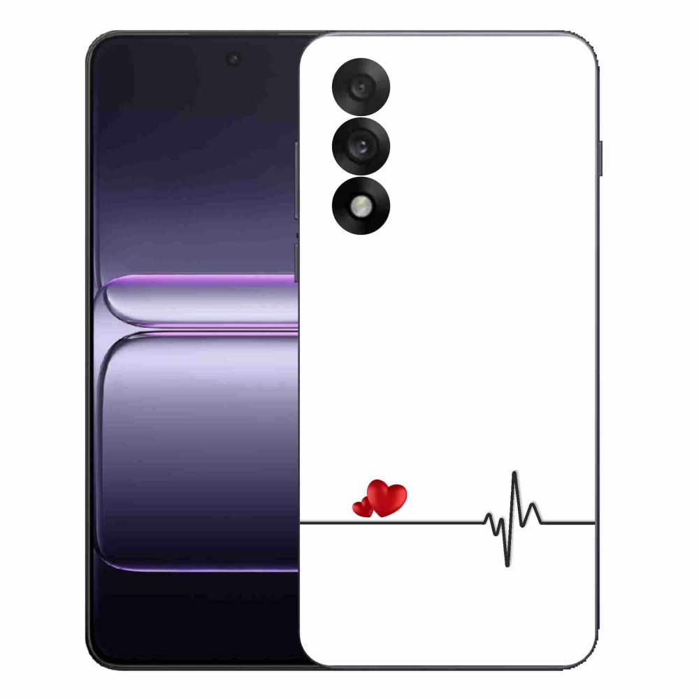 Gelový kryt mmCase na One Plus Nord 5 - srdce a tep bílé pozadí