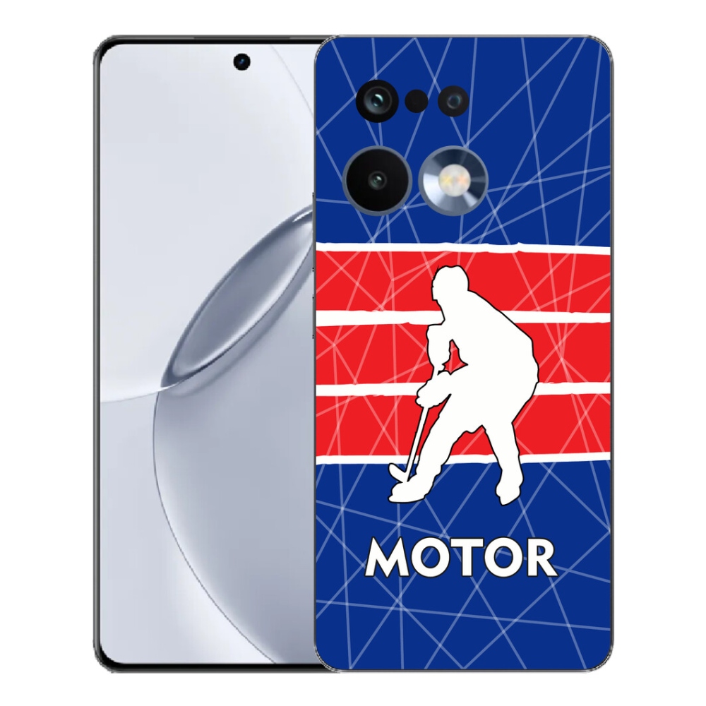 Gelový kryt mmCase na Realme 16 Pro+ - Motor