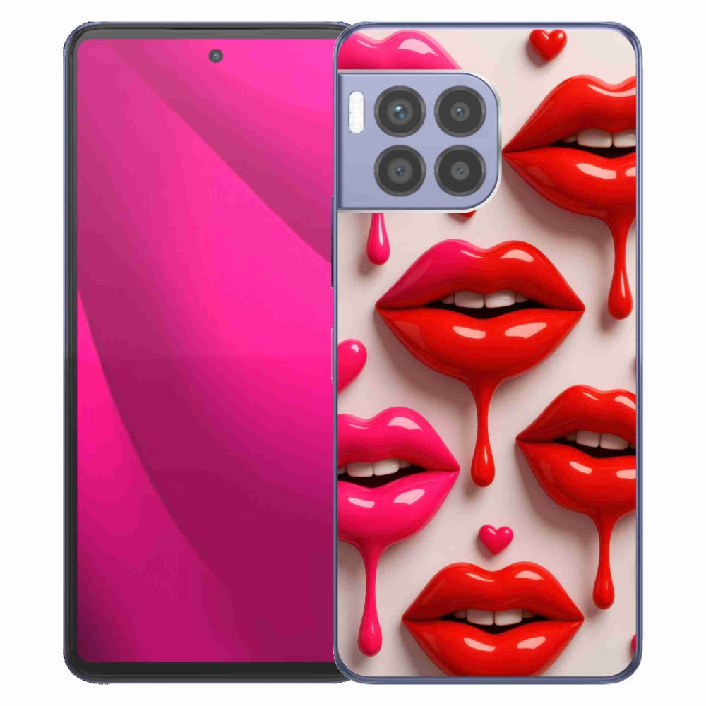 Gelový kryt mmCase na T phone 2 Pro - rty 2