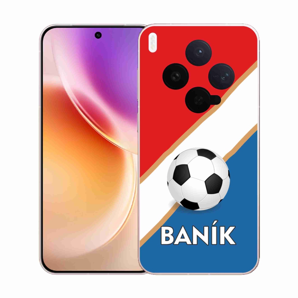 Gelový kryt mmCase na Vivo X300 - Baník