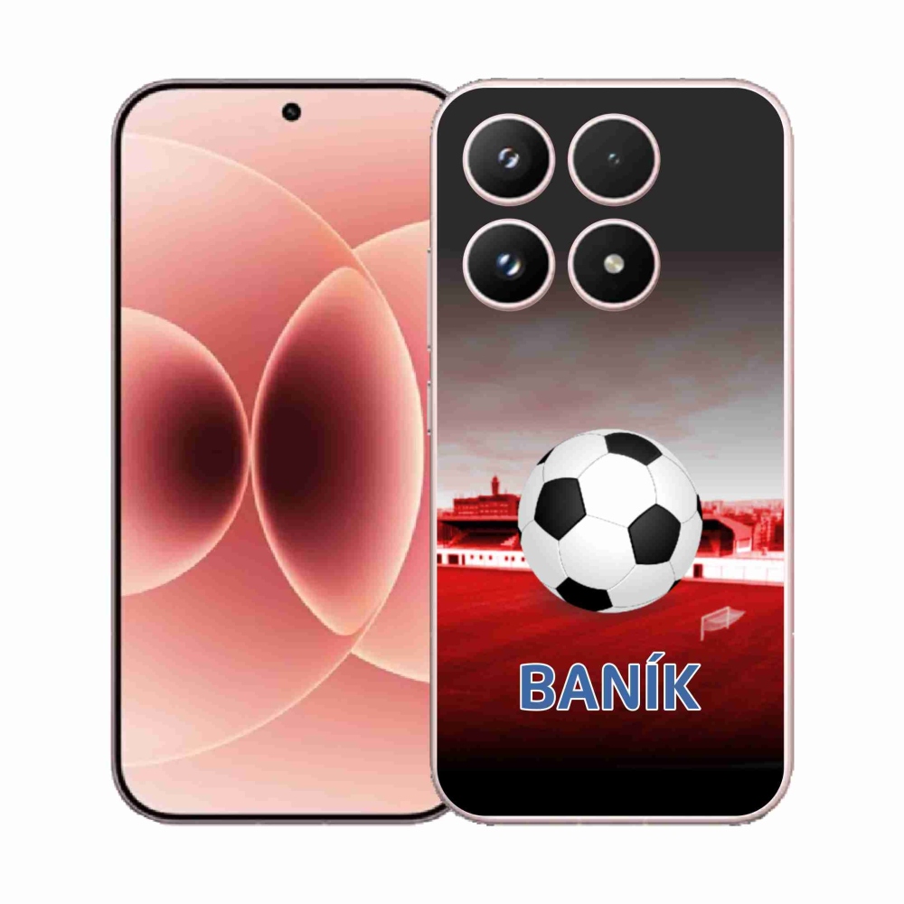 Gelový kryt mmCase na Xiaomi 17 - baník 1