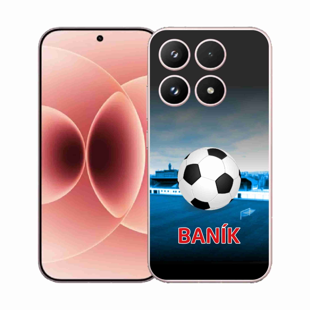 Gelový kryt mmCase na Xiaomi 17 - baník 2