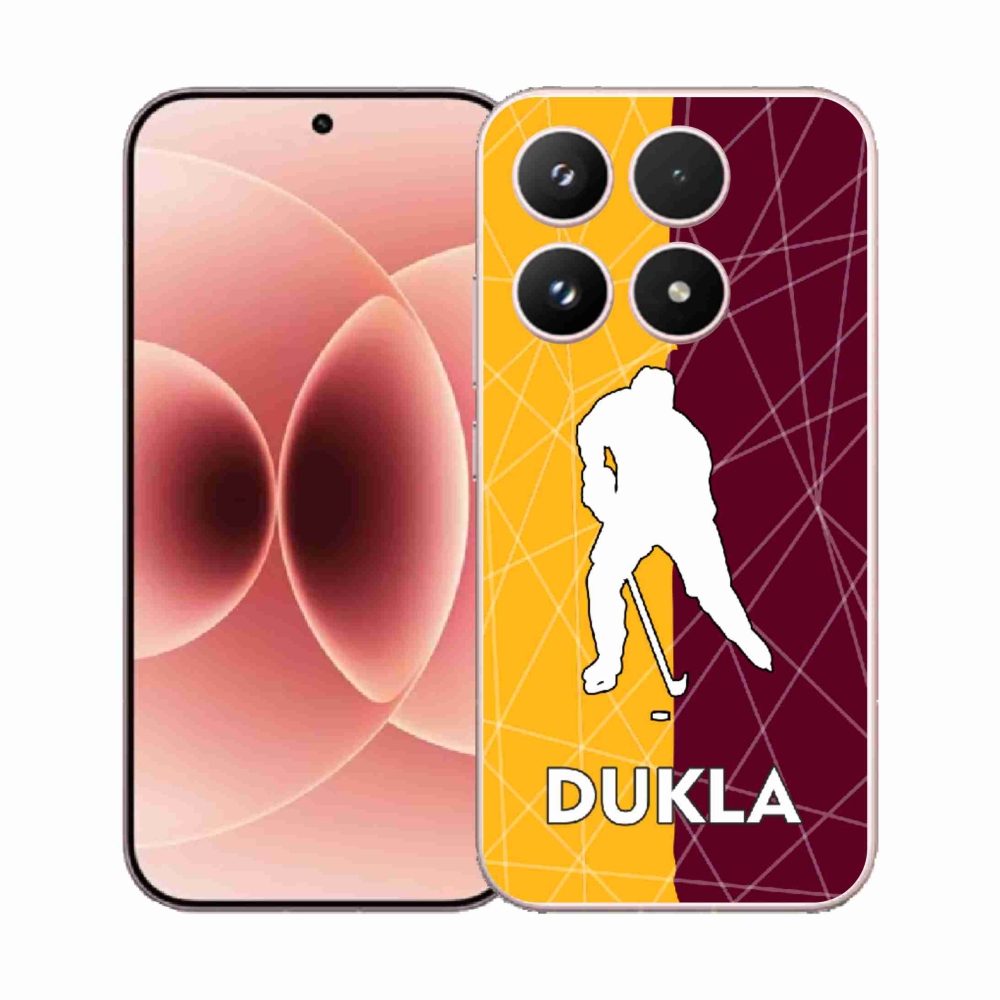 Gelový kryt mmCase na Xiaomi 17 - Dukla