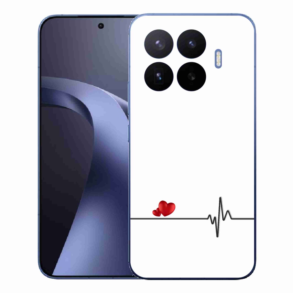 Gelový kryt mmCase na Xiaomi 17T Pro - srdce a tep bílé pozadí