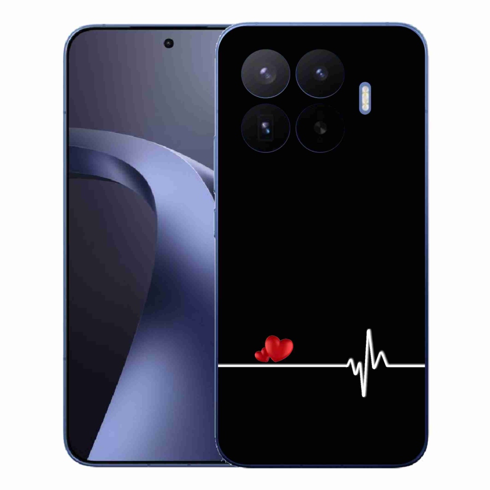 Gelový kryt mmCase na Xiaomi 17T Pro - srdce a tep černé pozadí
