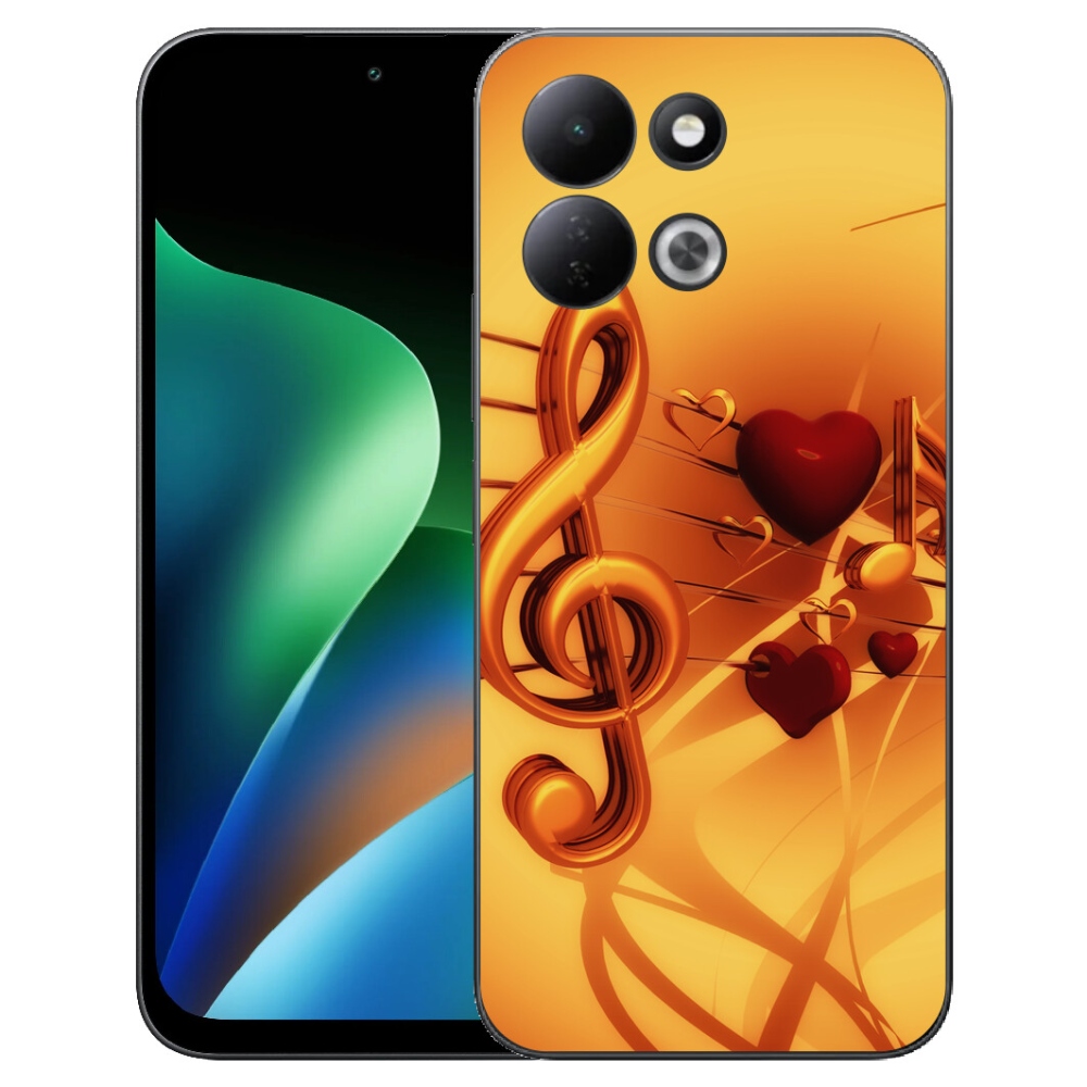 Gelový kryt mmCase na Xiaomi Redmi 17 4G/5G - noty