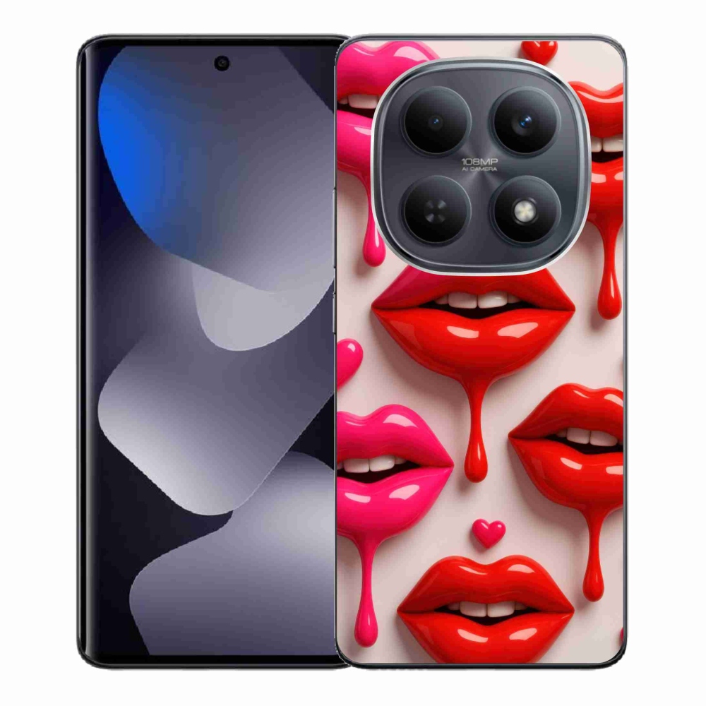 Gelový kryt mmCase na Xiaomi Redmi Note 15 4G - rty 2