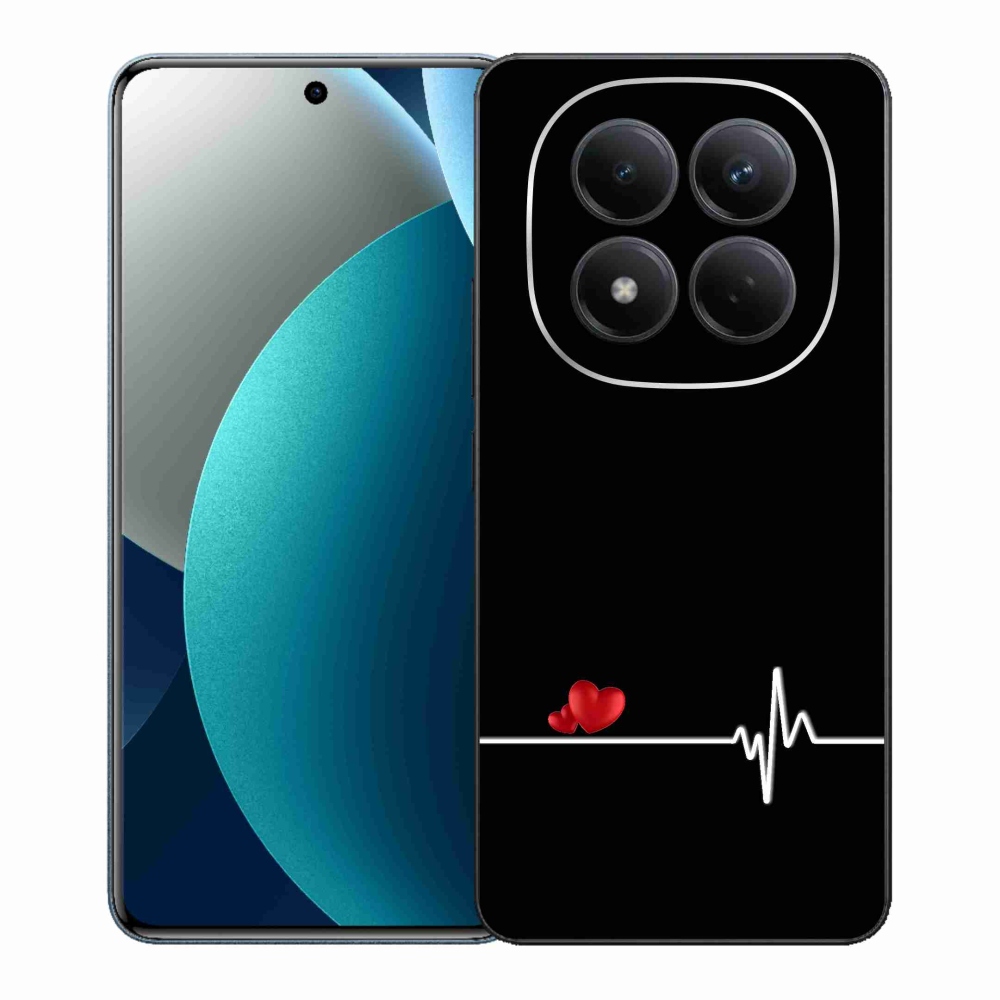 Gelový kryt mmCase na Xiaomi Redmi Note 15 Pro - srdce a tep černé pozadí