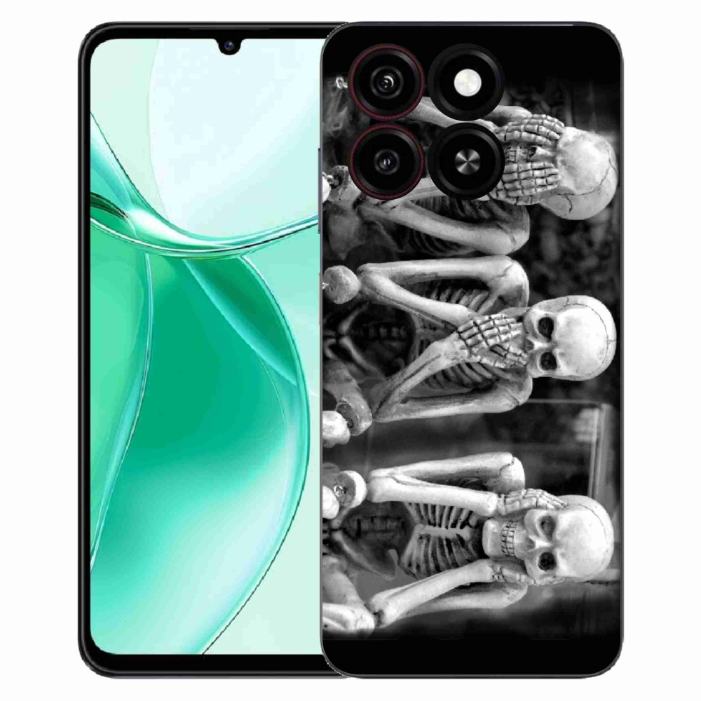 Gelový kryt mmCase na ZTE Blade A35 - kostlivci