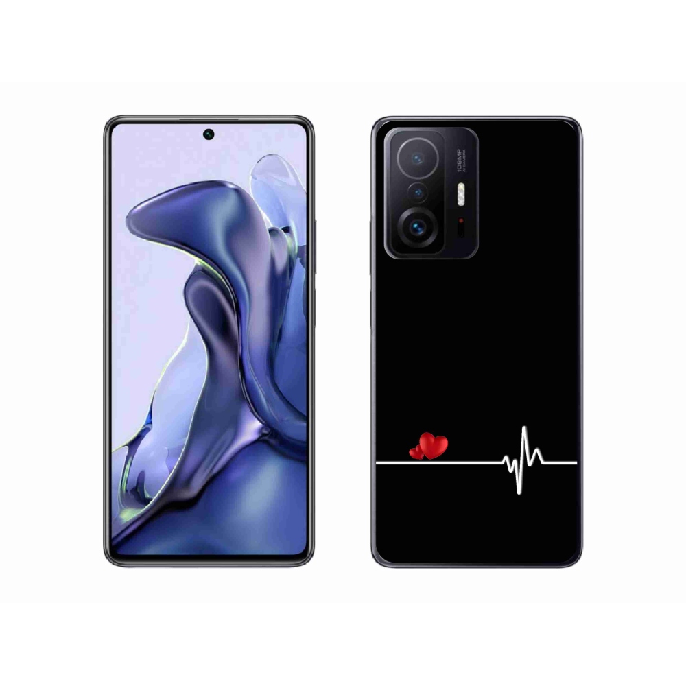 Gelový kryt mmCase na Xiaomi 11T Pro - srdce a tep černé pozadí