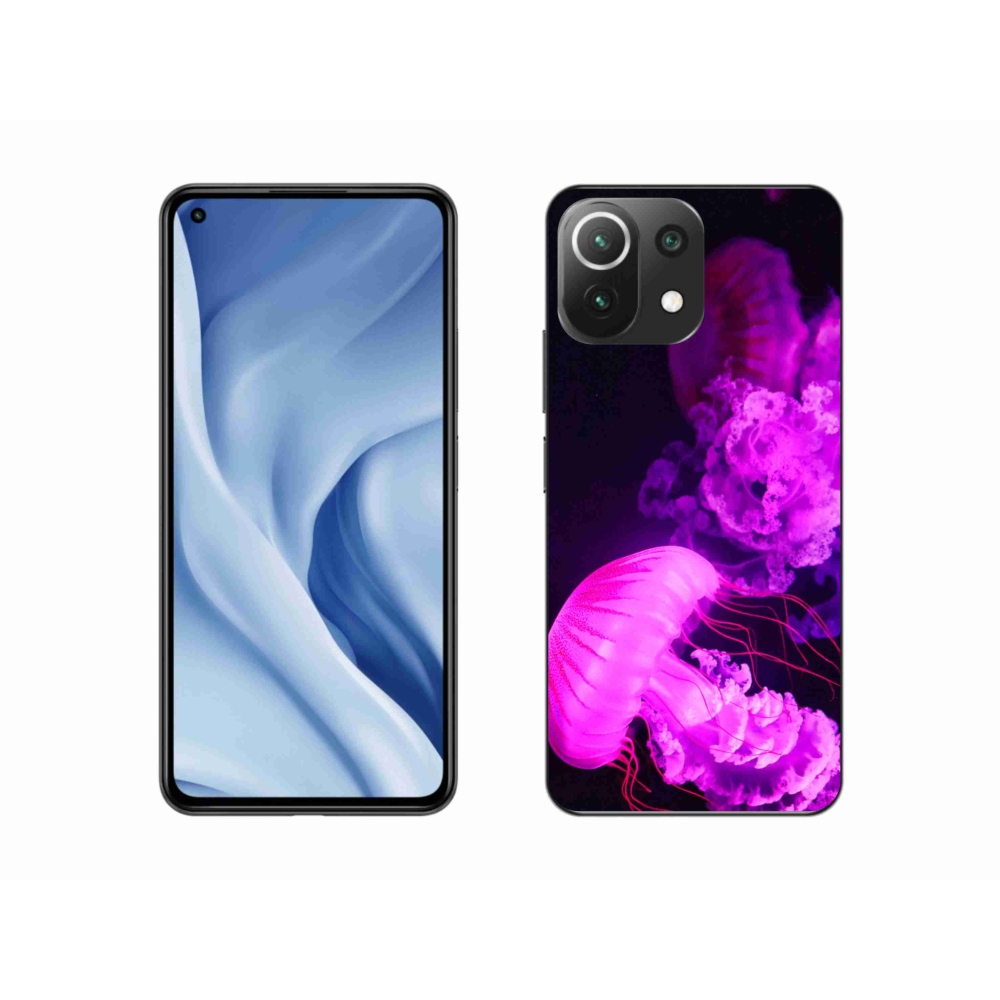 Gelový kryt mmCase na Xiaomi 11 Lite 5G NE - medúza 1