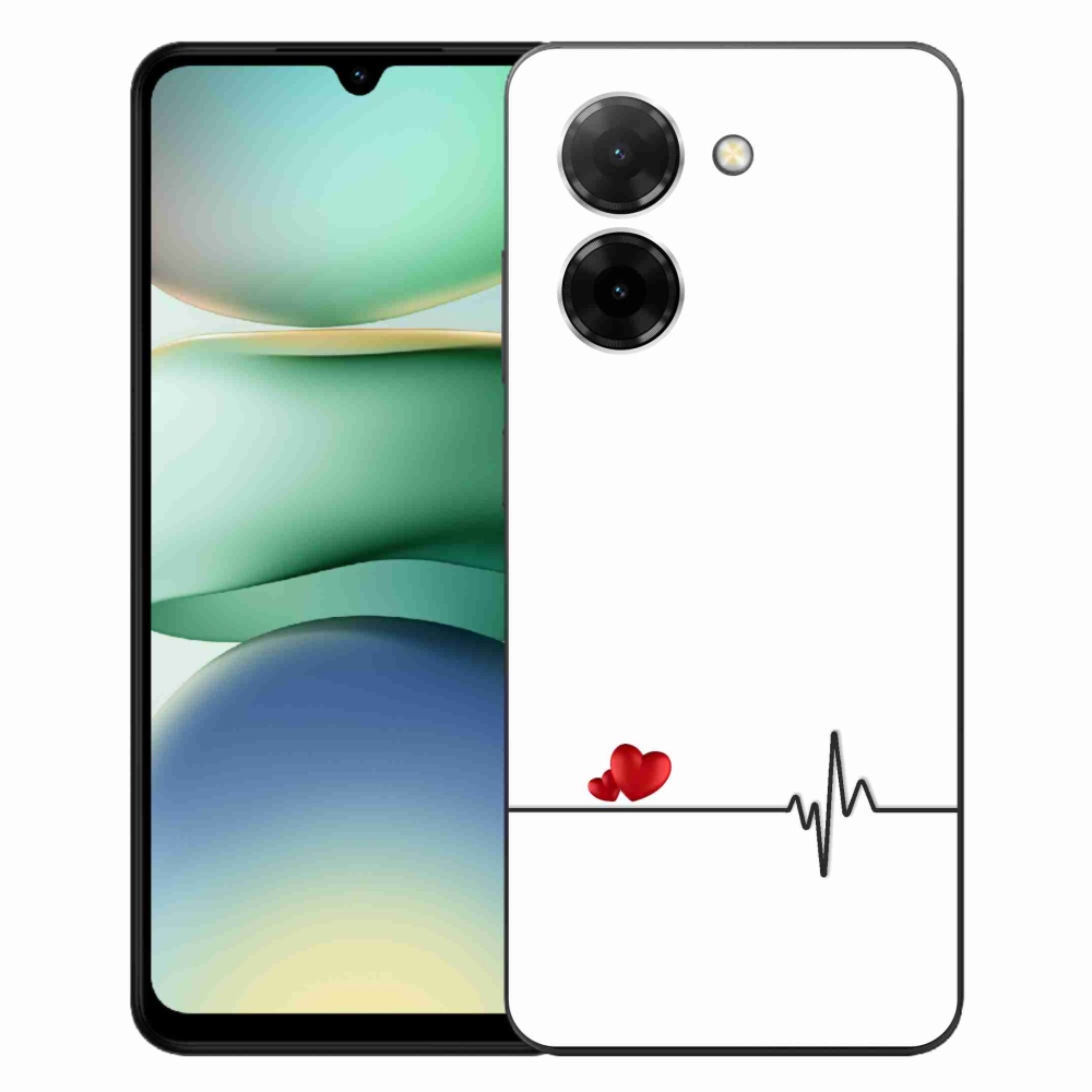 Gelový kryt mmCase na Xiaomi Redmi A5 (173.45x79.35x8.45mm) - srdce a tep bílé pozadí